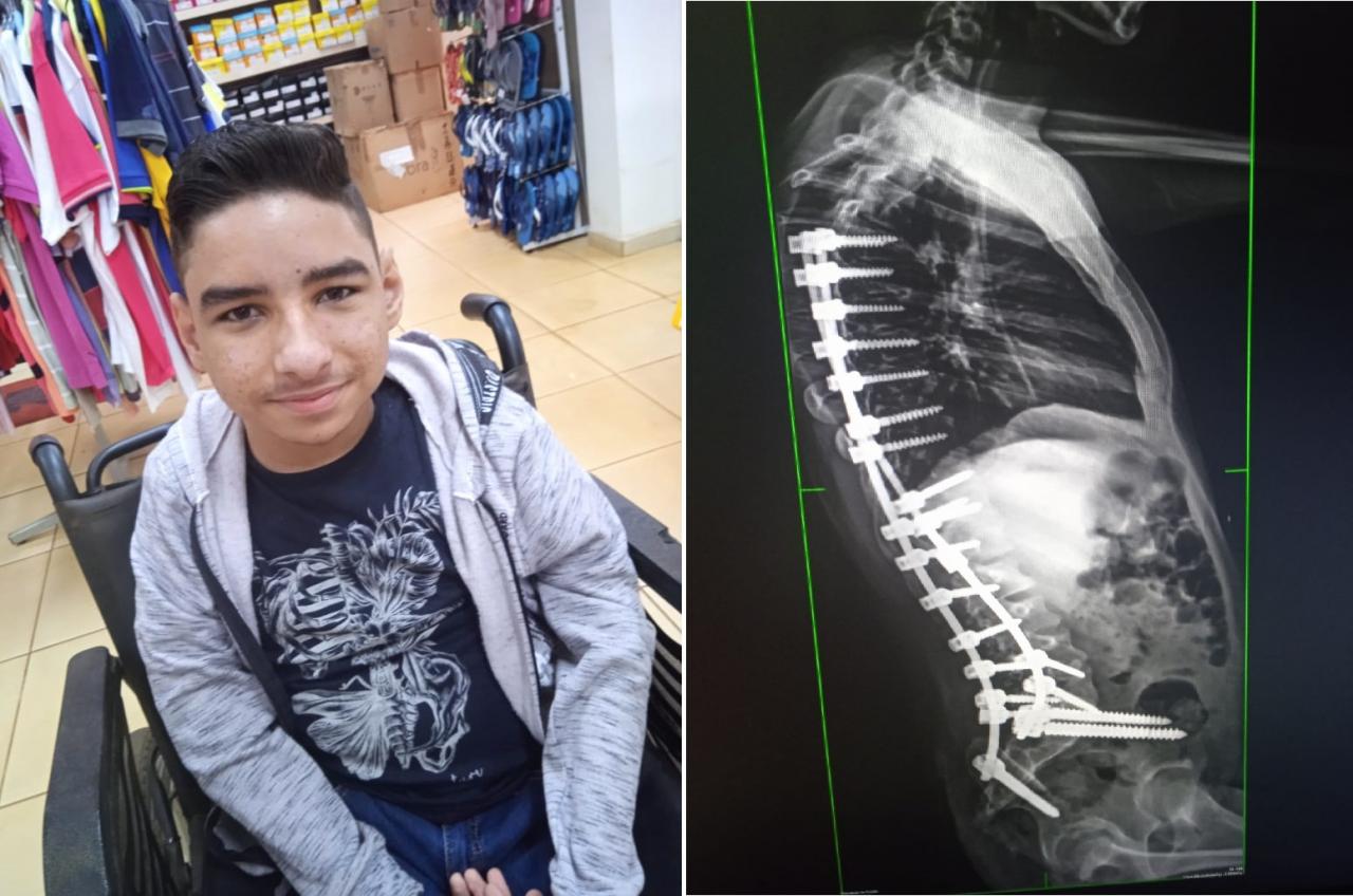 Estudante de 16 anos de Fênix, com doença genética rara, precisa de ajuda urgente.